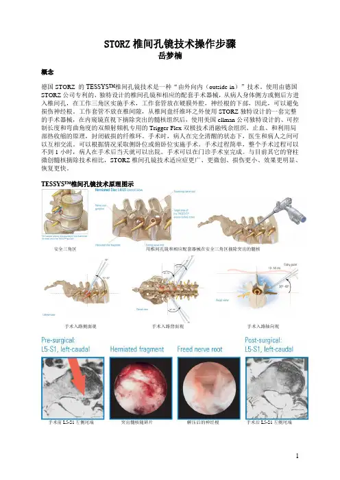 椎间孔镜手术配合