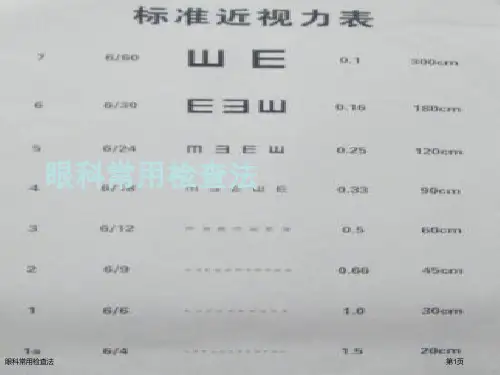 眼科常用检查法