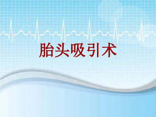 手术讲解模板：胎头吸引术