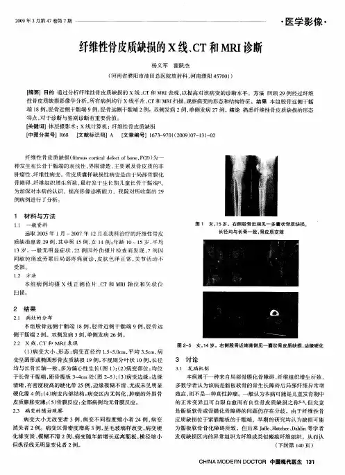 纤维性骨皮质缺损的X线、CT和MRI诊断