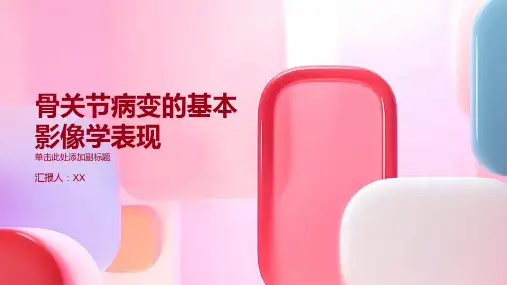 医学类第四章骨关节病变的基本影像学表现