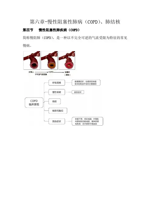 执业药师资格考试-药学综合知识与技能考试重点-慢性阻塞性肺病-(COPD)、肺结核