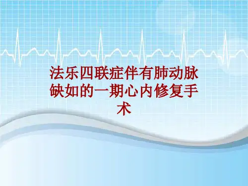 手术讲解模板：法乐四联症伴有肺动脉缺如的一期心内修复手术