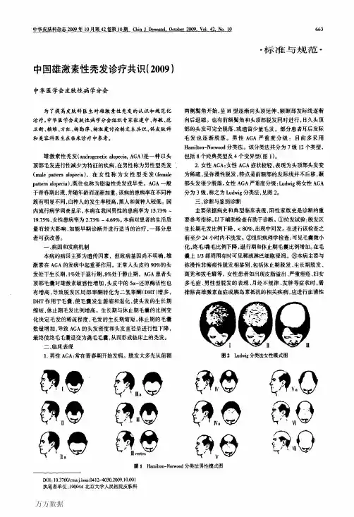中国雄激素性秃发诊疗共识(2009)