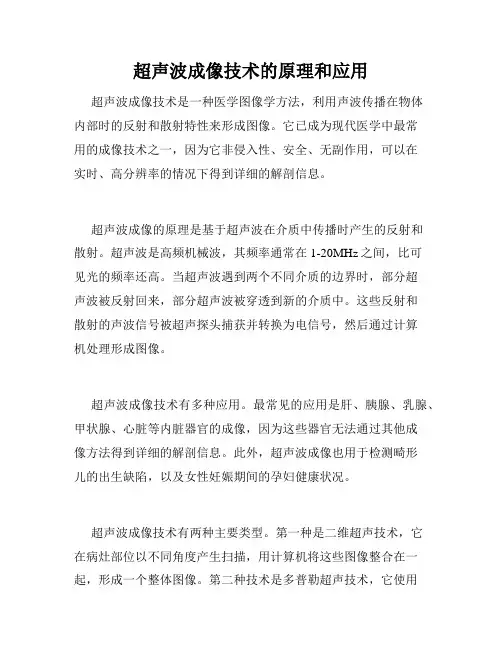 超声波成像技术的原理和应用