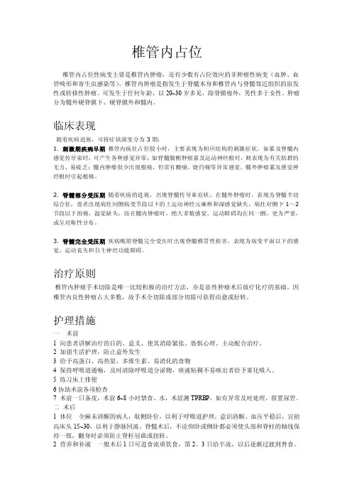 椎管内占位——精选推荐
