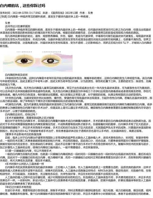 白内障的坑，这些你踩过吗