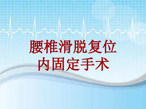 手术讲解模板：腰椎滑脱复位内固定手术