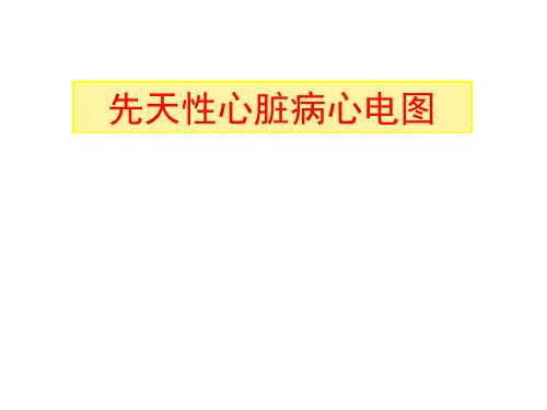 先天性心脏病心电图