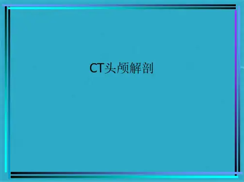 CT头颅解剖(共15张PPT)