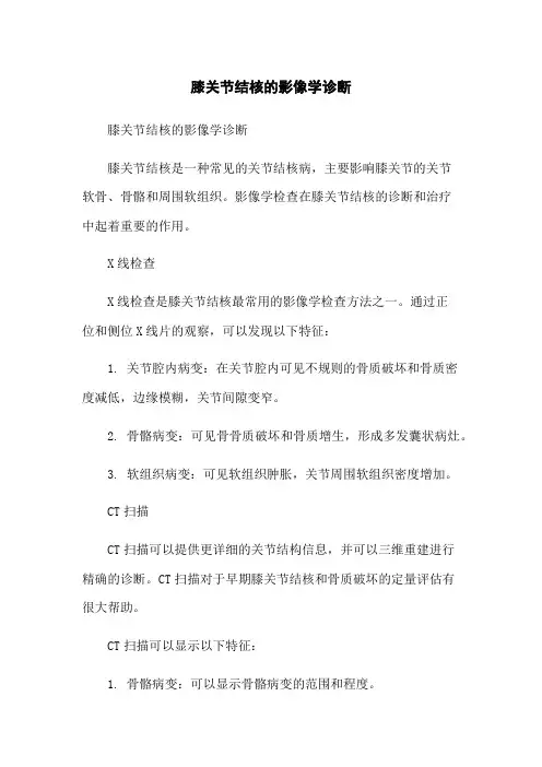 膝关节结核的影像学诊断