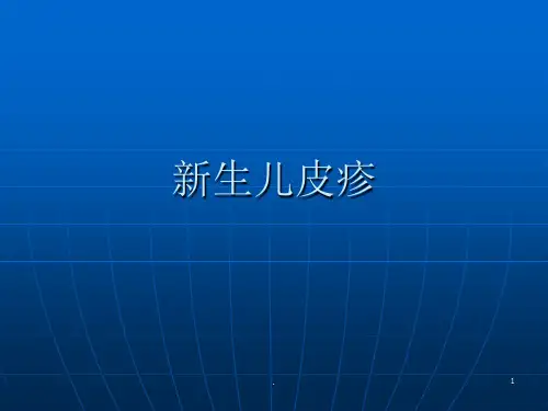 新生儿皮疹ppt课件