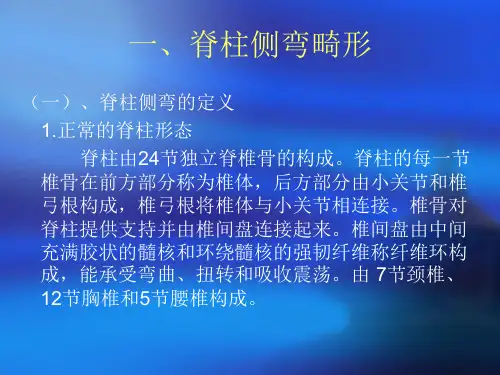 脊柱侧弯