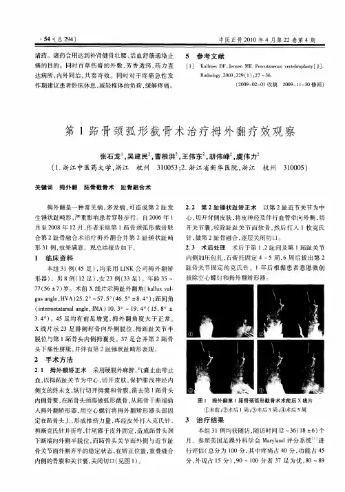 第1跖骨颈弧形截骨术治疗拇外翻疗效观察