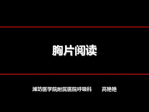 胸片阅读(必看)