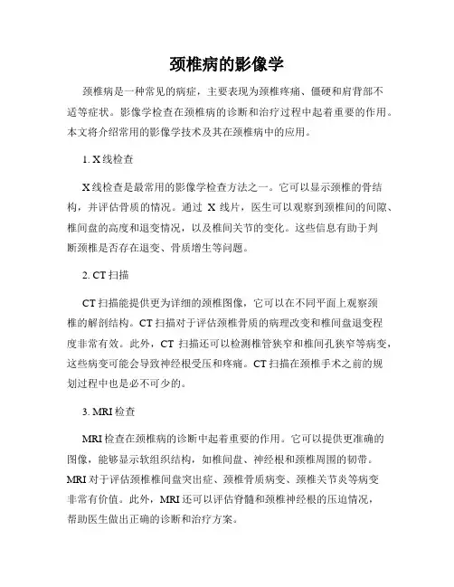 颈椎病的影像学