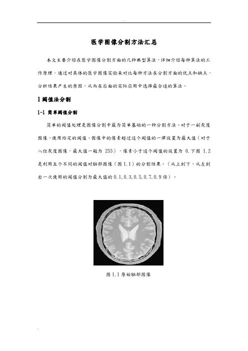 医学图像分割方法汇总