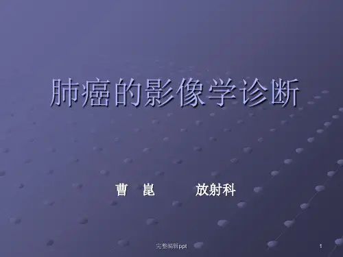肺癌影像诊断讲课ppt精选课件