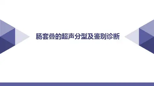 肠套叠的超声分型及鉴别诊断