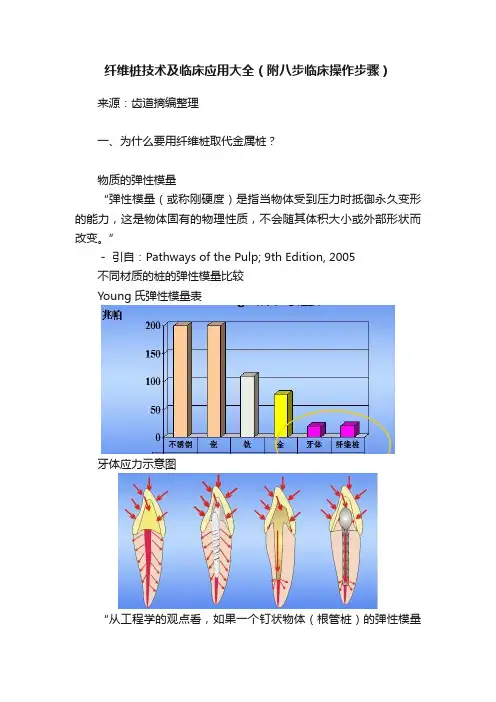 纤维桩技术及临床应用大全（附八步临床操作步骤）