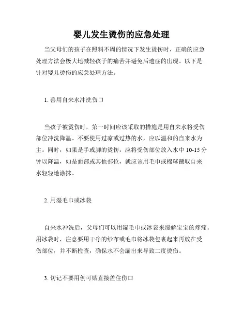 婴儿发生烫伤的应急处理
