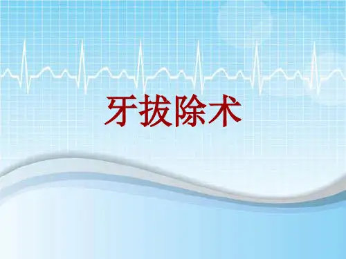 手术讲解模板：牙拔除术