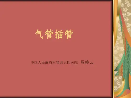 气管插管