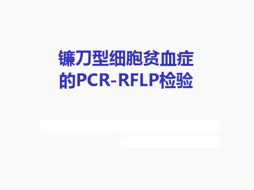 镰状细胞贫血症的PCR-RFLP检验