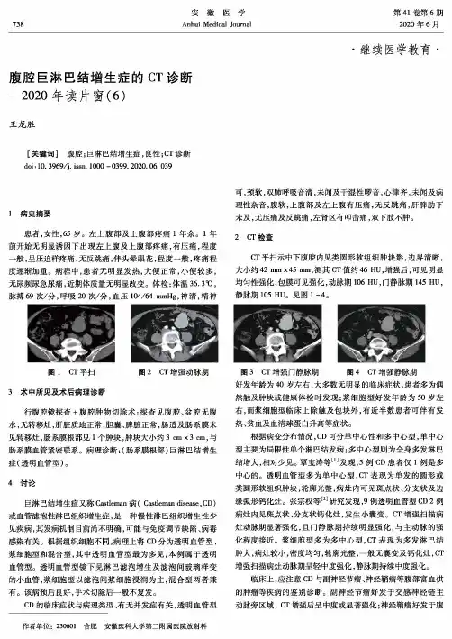 腹腔巨淋巴结增生症的CT诊断——2020年读片窗(6)