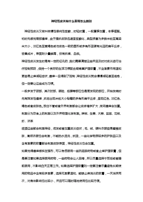 神经性皮炎有什么症状怎么分辨