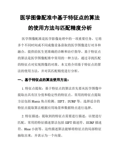 医学图像配准中基于特征点的算法的使用方法与匹配精度分析