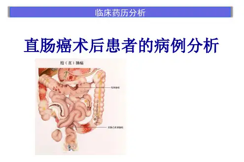 直肠腺癌ppt课件