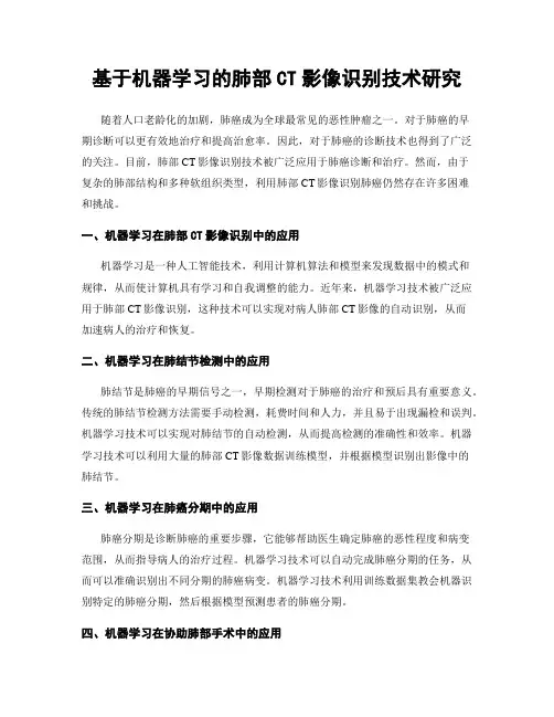 基于机器学习的肺部CT影像识别技术研究