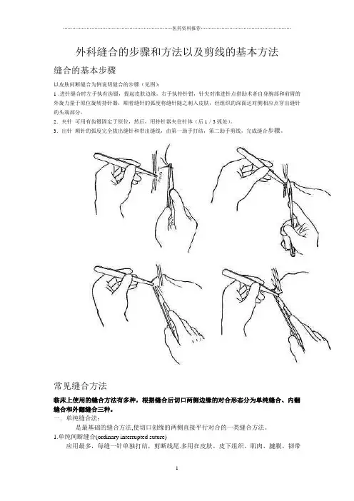 外科缝合的步骤和方法以及剪线的基本方法精编版