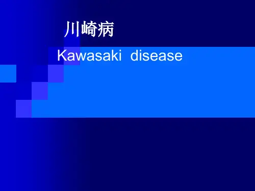 川崎病Kawasaki disease的简介