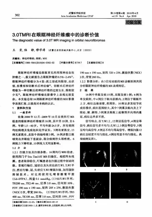 3.0TMRI在眼眶神经纤维瘤中的诊断价值