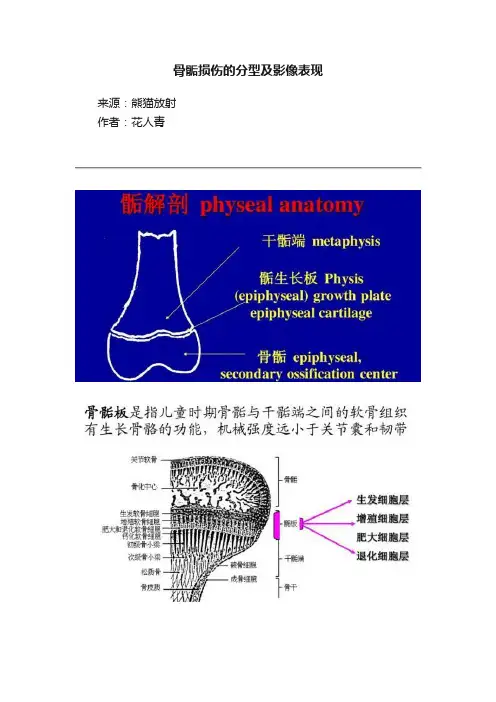 骨骺损伤的分型及影像表现