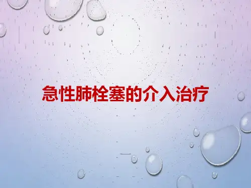 急性肺栓塞的介入治疗