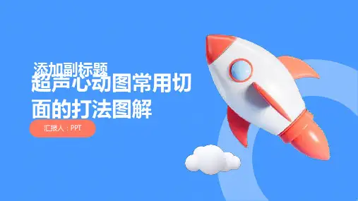 超声心动图常用切面的打法图解课件