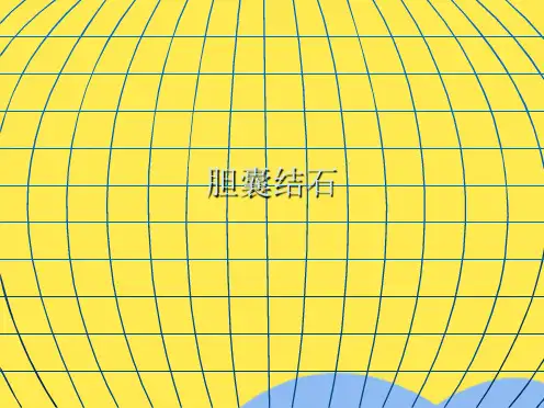 胆囊结石(共5张精选PPT)