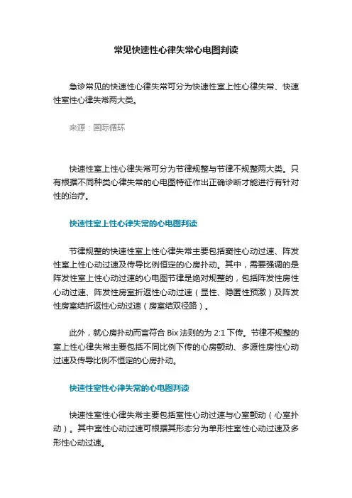 常见快速性心律失常心电图判读
