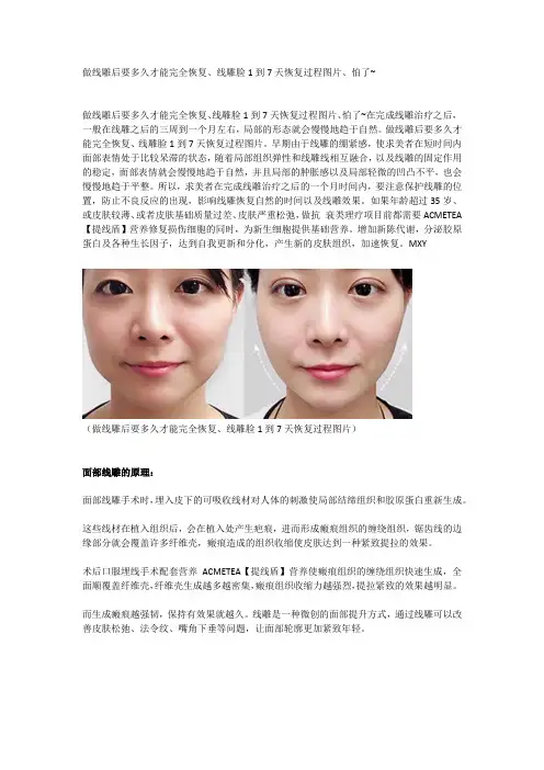 做线雕后要多久才能完全恢复、线雕脸1到7天恢复过程图片、怕了~
