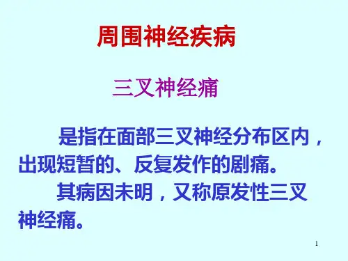 (精选课件)三叉神经痛PPT幻灯片