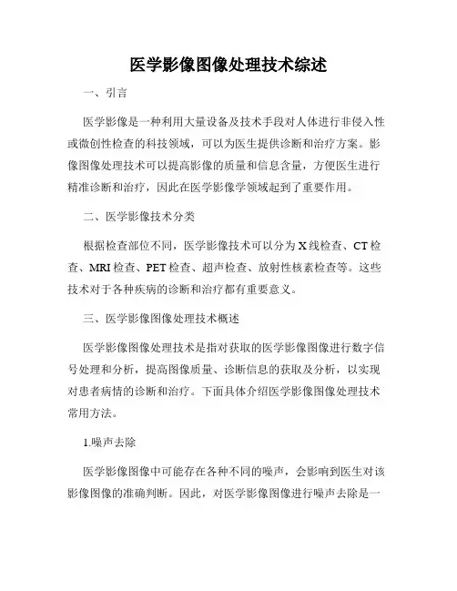 医学影像图像处理技术综述