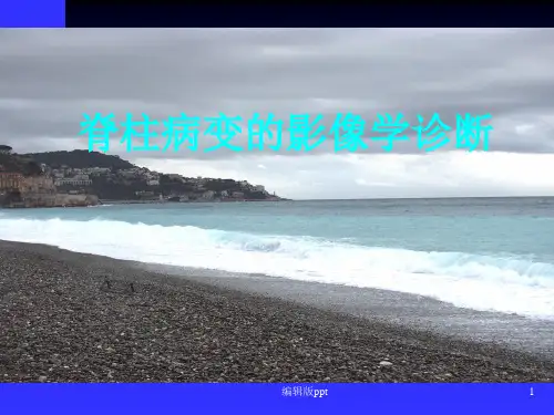 脊柱肿瘤ppt课件