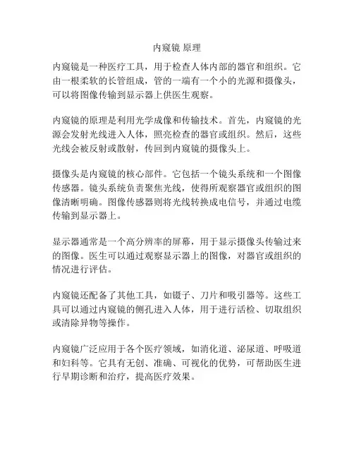 内窥镜 原理