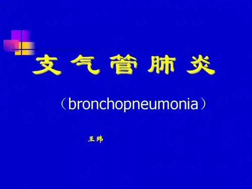 小儿支气管肺炎概述ppt课件