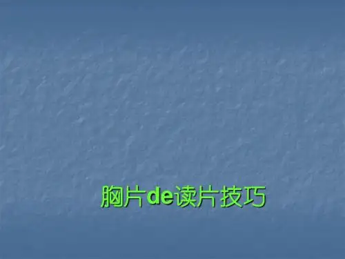 胸片读片技巧PPT课件