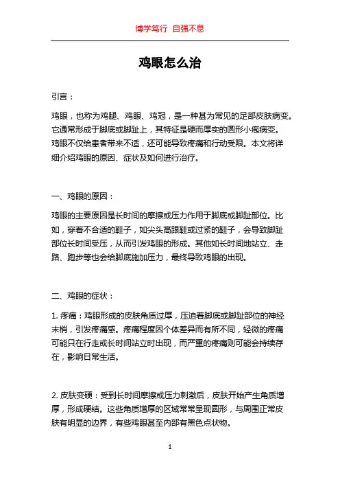 鸡眼怎么治