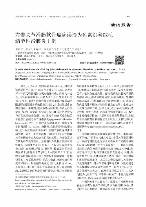 左髋关节滑膜软骨瘤病误诊为色素沉着绒毛结节性滑膜炎1例
